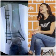 Ballersteros se recupera tras despome de templete en San Pédro