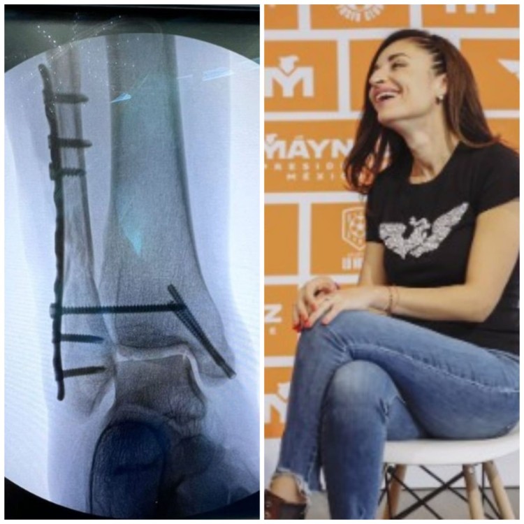 Ballersteros se recupera tras despome de templete en San Pédro